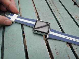 Casetify Apple Watch Band