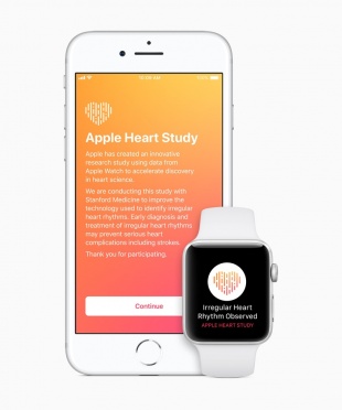 Apple Heart Study