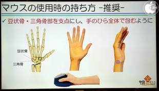 ロジクール MX Vertical アドバンスエルゴノミックマウス