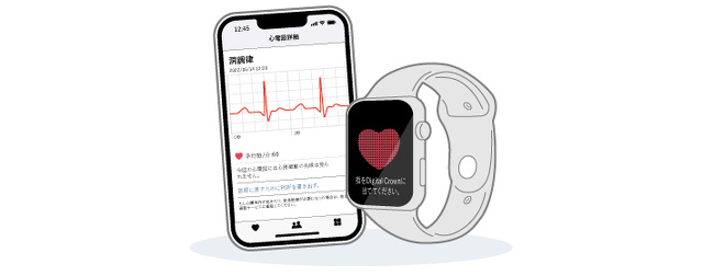 中部国際医療センター：Apple Watch 外来