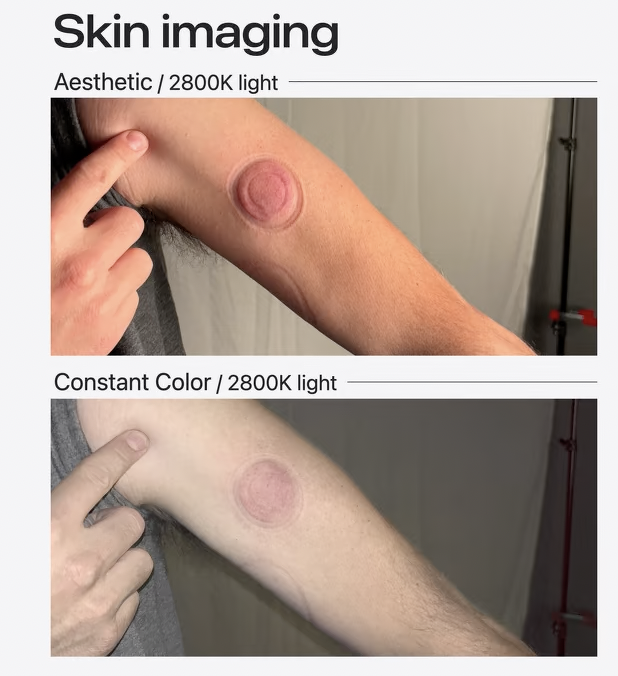 Skin imaging