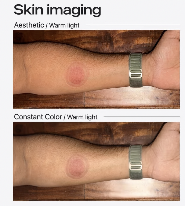Skin imaging