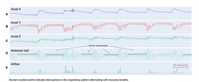 Apple Watchの加速度センサーのデータ(X、Y、Z)