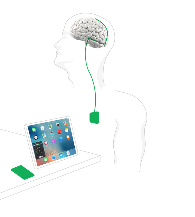 ブレイン・マシン・インターフェース (BCI) 