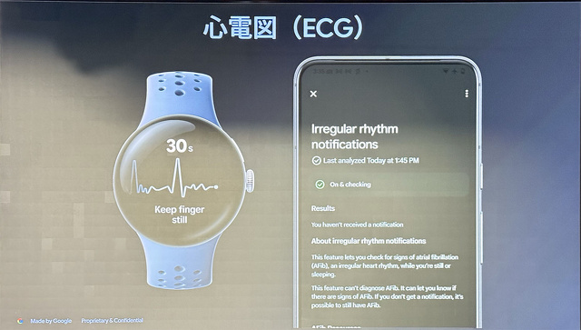 心電図（ECG）機能