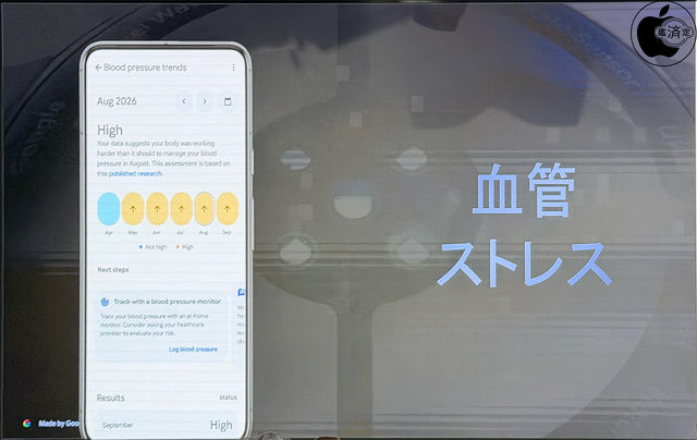 血管ストレス